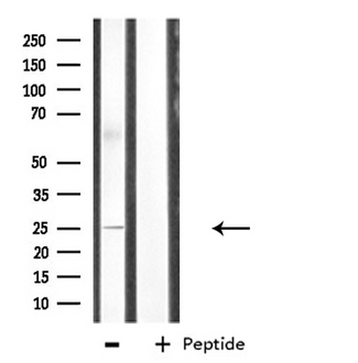 CDC42EP3 Antibody - Western blot analysis of extracts of K562 cells using CDC42EP3 antibody.
