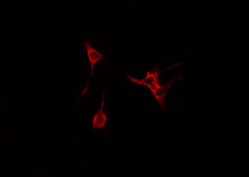 CDC42EP3 Antibody - Staining HeLa cells by IF/ICC. The samples were fixed with PFA and permeabilized in 0.1% Triton X-100, then blocked in 10% serum for 45 min at 25°C. The primary antibody was diluted at 1:200 and incubated with the sample for 1 hour at 37°C. An Alexa Fluor 594 conjugated goat anti-rabbit IgG (H+L) antibody, diluted at 1/600, was used as secondary antibody.