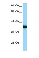 CDC42EP4 / BORG4 Antibody - CDC42EP4 antibody Western blot of Rat Liver lysate. Antibody concentration 1 ug/ml.  This image was taken for the unconjugated form of this product. Other forms have not been tested.