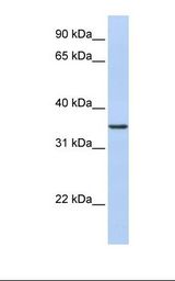 CDC42EP4 / BORG4 Antibody - 721_B cell lysate. Antibody concentration: 1.0 ug/ml. Gel concentration: 12%.  This image was taken for the unconjugated form of this product. Other forms have not been tested.