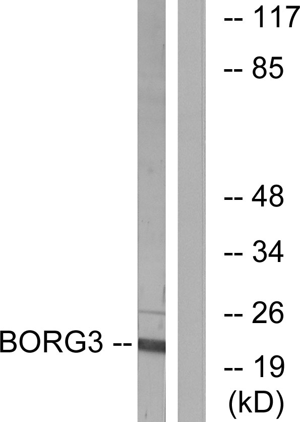 CDC42EP5 Antibody - Western blot analysis of lysates from Jurkat cells, using BORG3 Antibody. The lane on the right is blocked with the synthesized peptide.