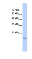 CDC42EP5 Antibody - CDC42EP5 antibody Western blot of Transfected 293T cell lysate. This image was taken for the unconjugated form of this product. Other forms have not been tested.