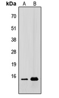 CDC42EP5 Antibody - Western blot analysis of CDC42EP5 expression in HEK293T (A); A431 (B) whole cell lysates.