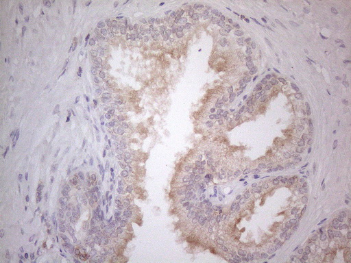 CDC42SE2 Antibody - Immunohistochemical staining of paraffin-embedded Human prostate tissue within the normal limits using anti-CDC42SE2 mouse monoclonal antibody. (Heat-induced epitope retrieval by 1mM EDTA in 10mM Tris buffer. (pH8.5) at 120°C for 3 min. (1:150)
