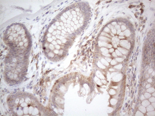 CDC42SE2 Antibody - Immunohistochemical staining of paraffin-embedded Human colon tissue within the normal limits using anti-CDC42SE2 mouse monoclonal antibody. (Heat-induced epitope retrieval by 1mM EDTA in 10mM Tris buffer. (pH8.5) at 120°C for 3 min. (1:150)