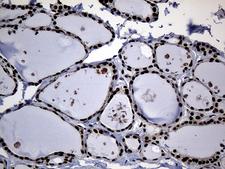 CDC45 Antibody - Immunohistochemical staining of paraffin-embedded Human breast tissue within the normal limits using anti-CDC45 mouse monoclonal antibody. (Heat-induced epitope retrieval by 1mM EDTA in 10mM Tris buffer. (pH8.5) at 120°C for 3 min. (1:500)