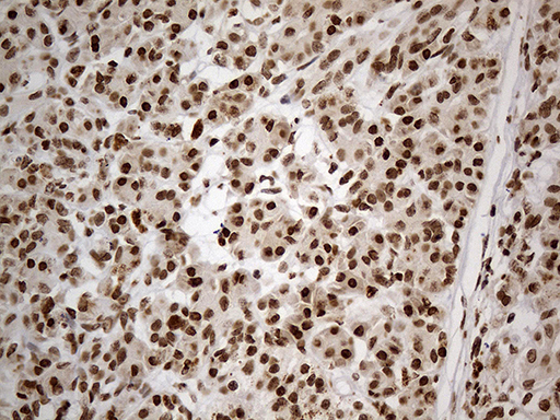 CDC45 Antibody - Immunohistochemical staining of paraffin-embedded Human pancreas tissue within the normal limits using anti-CDC45 mouse monoclonal antibody. (Heat-induced epitope retrieval by 1mM EDTA in 10mM Tris buffer. (pH8.5) at 120°C for 3 min. (1:500)