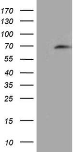 CDC45 Antibody - HEK293T cells were transfected with the pCMV6-ENTRY control. (Left lane) or pCMV6-ENTRY CDC45. (Right lane) cDNA for 48 hrs and lysed