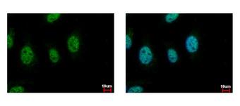 CDC45 Antibody - CDC45L antibody [C1C3] detects CDC45L protein at nucleus by immunofluorescent analysis. HeLa cells were fixed in 4% paraformaldehyde at RT for 15 min. CDC45L protein stained by CDC45L antibody [C1C3] diluted at 1:500.