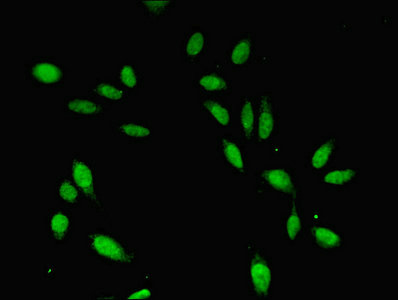 CDC45 Antibody - Immunofluorescent analysis of Hela cells cells diluted at 1:100 and Alexa Fluor 488-congugated AffiniPure Goat Anti-Rabbit IgG(H+L)