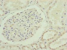 CDC45 Antibody - Immunohistochemistry of paraffin-embedded human kidney tissue at dilution of 1:100