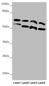 CDC45 Antibody - Western blot All Lanes:CDC45 antibody at 0.3 ug/ml Lane 1: K562 whole cell lysate Lane 2: 293T whole cell lysate Lane 3: Hela whole cell lysate Lane 4: HepG-2 whole cell lysate Secondary Goat polyclonal to rabbit IgG at 1/10000 dilution Predicted band size: 66,61,69 kDa Observed band size: 66,58 kDa