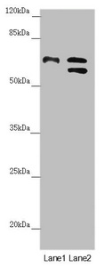 CDC45 Antibody - Western blot All Lanes:CDC45 antibody at 1.05 ug/ml Lane 1: K562 whole cell lysate Lane 2: 293T whole cell lysate Secondary Goat polyclonal to rabbit IgG at 1/10000 dilution Predicted band size: 66,61,69 kDa Observed band size: 66,58 kDa