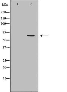 CDC45 Antibody - Western blot analysis of HeLa whole cells lysates using cdc45 antibody. The lane on the left is treated with the antigen-specific peptide.