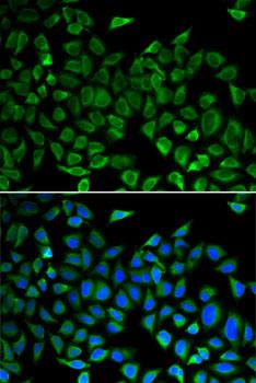 CDC45 Antibody - Immunofluorescence analysis of A549 cells using CDC45 Polyclonal Antibody.