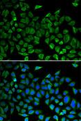 CDC45 Antibody - Immunofluorescence analysis of A549 cells using CDC45 Polyclonal Antibody.