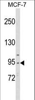 CDC5 / CDC5L Antibody - Western blot of CDC5L Antibody in MCF-7 cell line lysates (35 ug/lane). CDC5L (arrow) was detected using the purified antibody.