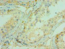 CDC5 / CDC5L Antibody - Immunohistochemistry of paraffin-embedded human testicle using antibody at 1:100 dilution.