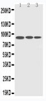 CDC5 / CDC5L Antibody - WB of CDC5 / CDC5L antibody. Lane 1: HELA Cell Lysate. Lane 2: RAJI Cell Lysate. Lane 3: A549 Cell Lysate.