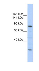 CDC5 / CDC5L Antibody - CDC5L antibody Western blot of 721_B cell lysate. This image was taken for the unconjugated form of this product. Other forms have not been tested.