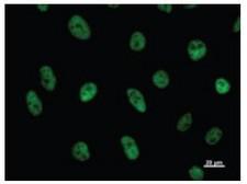 CDC5 / CDC5L Antibody - Immunofluorescent staining using CDC5L antibody. Immunostaining analysis in HeLa cells. HeLa cells were fixed with 4% paraformaldehyde and permeabilized with 0.01% Triton-X100 in PBS. The cells were immunostained with anti-CDC5L antibody.