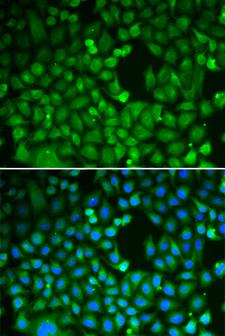 CDC5 / CDC5L Antibody - Immunofluorescence analysis of HeLa cells.