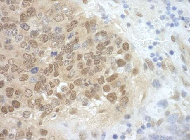 CDC6 Antibody - Detection of Mouse CDC6 by Immunohistochemistry. Sample: FFPE section of mouse teratoma. Antibody: Affinity purified rabbit anti-CDC6 used at a dilution of 1:100.