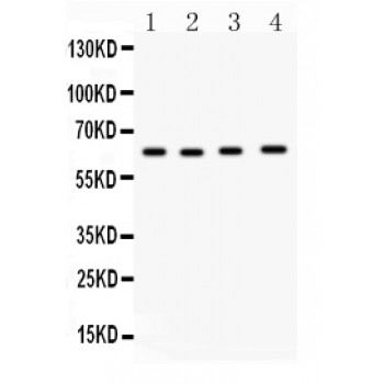 CDC6 Antibody - Cdc6 antibody Western blot. All lanes: Anti Cdc6 at 0.5 ug/ml. Lane 1: Rat Brain Tissue Lysate at 50 ug. Lane 2: JURKAT Whole Cell Lysate at 40 ug. Lane 3: MM231 Whole Cell Lysate at 40 ug. Lane 4: HT1080 Whole Cell Lysate at 40 ug. Predicted band size: 63 kD. Observed band size: 63 kD.