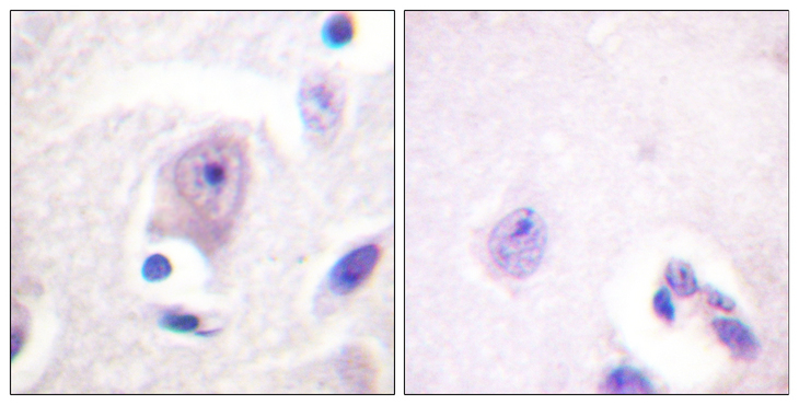 CDC6 Antibody - Immunohistochemistry analysis of paraffin-embedded human brain tissue, using CDC6 Antibody. The picture on the right is blocked with the synthesized peptide.