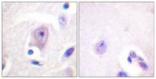 CDC6 Antibody - Immunohistochemistry analysis of paraffin-embedded human brain tissue, using CDC6 Antibody. The picture on the right is blocked with the synthesized peptide.