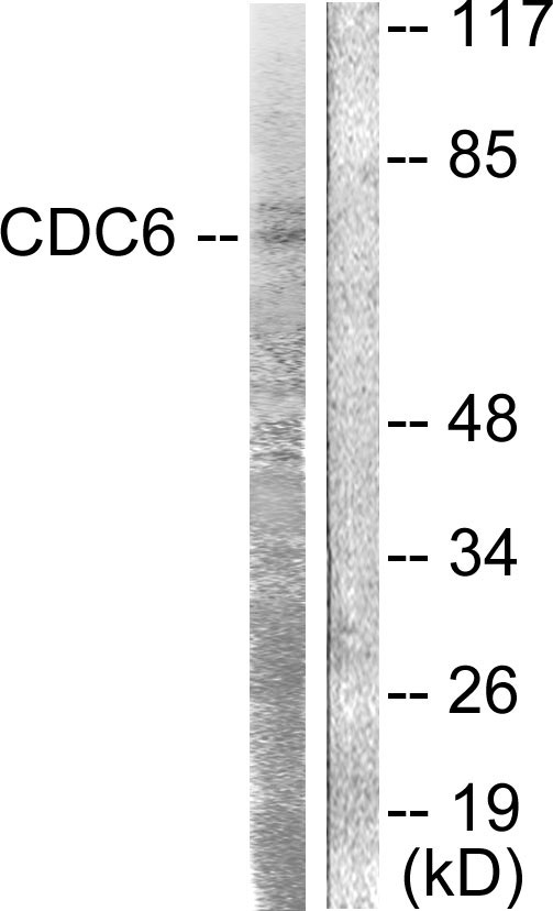 CDC6 Antibody - Western blot analysis of lysates from HT-29 cells, using CDC6 Antibody. The lane on the right is blocked with the synthesized peptide.