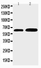 CDC6 Antibody - WB of CDC6 antibody. Lane 1: JURKAT Cell Lysate. Lane 2: MCF-7 Cell Lysate.