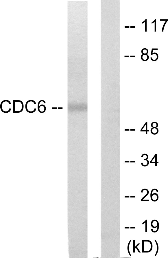 CDC6 Antibody - Western blot analysis of lysates from K562 cells, using CDC6 Antibody. The lane on the right is blocked with the synthesized peptide.