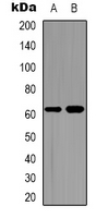 CDC6 Antibody - Western blot analysis of CDC6 expression in HeLa (A); Jurkat (B) whole cell lysates.