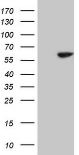 CDC6 Antibody - HEK293T cells were transfected with the pCMV6-ENTRY control. (Left lane) or pCMV6-ENTRY CDC6. (Right lane) cDNA for 48 hrs and lysed. Equivalent amounts of cell lysates. (5 ug per lane) were separated by SDS-PAGE and immunoblotted with anti-CDC6. (1:500)