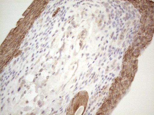CDC6 Antibody - Immunohistochemical staining of paraffin-embedded Human bladder tissue within the normal limits using anti-CDC6 mouse monoclonal antibody. (Heat-induced epitope retrieval by 1mM EDTA in 10mM Tris buffer. (pH8.5) at 120°C for 3 min. (1:150)