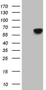 CDC6 Antibody - HEK293T cells were transfected with the pCMV6-ENTRY control. (Left lane) or pCMV6-ENTRY CDC6. (Right lane) cDNA for 48 hrs and lysed. Equivalent amounts of cell lysates. (5 ug per lane) were separated by SDS-PAGE and immunoblotted with anti-CDC6. (1:2000)