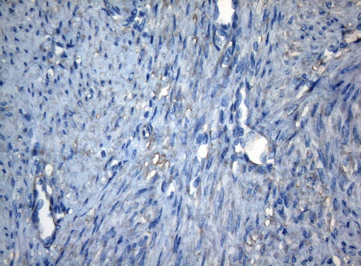 CDC6 Antibody - Immunohistochemical staining of paraffin-embedded Human endometrium tissue within the normal limits using anti-CDC6 mouse monoclonal antibody. (Heat-induced epitope retrieval by 1mM EDTA in 10mM Tris buffer. (pH8.5) at 120°C for 3 min. (1:150)