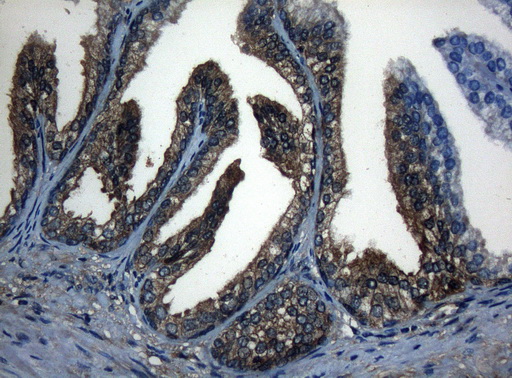 CDC6 Antibody - Immunohistochemical staining of paraffin-embedded Human prostate tissue within the normal limits using anti-CDC6 mouse monoclonal antibody. (Heat-induced epitope retrieval by 1mM EDTA in 10mM Tris buffer. (pH8.5) at 120°C for 3 min. (1:150)