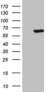 CDC6 Antibody - HEK293T cells were transfected with the pCMV6-ENTRY control. (Left lane) or pCMV6-ENTRY CDC6. (Right lane) cDNA for 48 hrs and lysed. Equivalent amounts of cell lysates. (5 ug per lane) were separated by SDS-PAGE and immunoblotted with anti-CDC6. (1:2000)