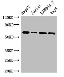 CDC6 Antibody - Positive WB detected in:HepG2 whole cell lysate,Jurkat whole cell lysate,RAW264.7 whole cell lysate,Raji whole cell lysate;All lanes:CDC6 antibody at 2.5?g/ml;Secondary;Goat polyclonal to rabbit IgG at 1/50000 dilution;Predicted band size: 63 KDa;Observed band size: 63 KDa;