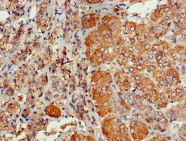 CDC6 Antibody - Immunohistochemistry of paraffin-embedded human adrenal gland tissue using CDC6 Antibody at dilution of 1:100