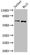 CDC6 Antibody - Western Blot Positive WB detected in: Jurkat whole cell lysate, Raji whole cell lysate All lanes: CDC6 antibody at 2.5µg/ml Secondary Goat polyclonal to rabbit IgG at 1/50000 dilution Predicted band size: 63 kDa Observed band size: 63 kDa