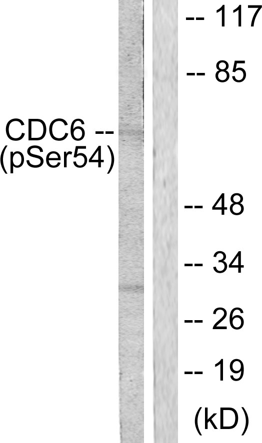 CDC6 Antibody - Western blot analysis of lysates from COS7 cells treated with EGF 200ng/ml 30', using CDC6 (Phospho-Ser54) Antibody. The lane on the right is blocked with the phospho peptide.