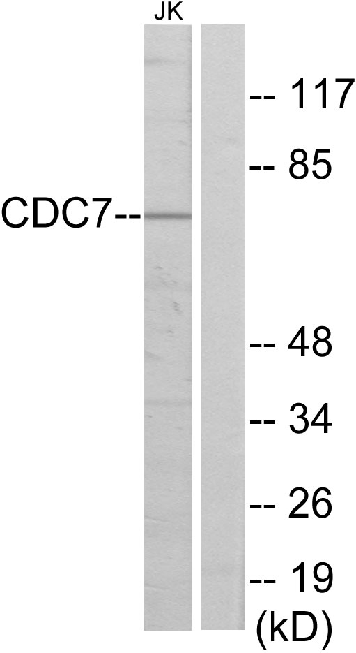 CDC7 Antibody - Western blot analysis of lysates from Jurkat cells, using CDC7 Antibody. The lane on the right is blocked with the synthesized peptide.