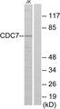 CDC7 Antibody - Western blot analysis of lysates from Jurkat cells, using CDC7 Antibody. The lane on the right is blocked with the synthesized peptide.
