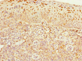 CDC7 Antibody - Immunohistochemistry of paraffin-embedded human tonsil tissue at dilution 1:100
