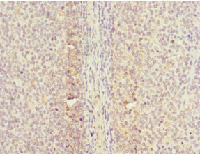 CDC7 Antibody - Immunohistochemistry of paraffin-embedded human tonsil tissue at dilution 1:100