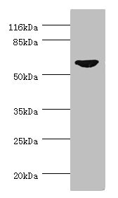 CDC7 Antibody - Western blot All Lanes:CDC7 antibody at 0.95ug/ml+SY-5Y whole cell lysate Secondary Goat polyclonal to rabbit at 1/10000 dilution Predicted band size: 64kDa Observed band size: 64kDa
