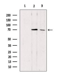 CDC7 Antibody - Western blot analysis of extracts of various samples using CDC7 antibody. Lane 1: mouse Myeloma cells treated with blocking peptide. Lane 2: mouse Myeloma cells; Lane 3: mouse brain;